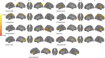Test-Retest Reliability of fMRI During an Emotion Processing Task: Investigating the Impact of Analytical Approaches on ICC Values